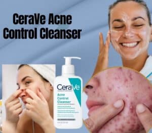 CeraVe Acne Control Cleanser pore cleansing solution 2024