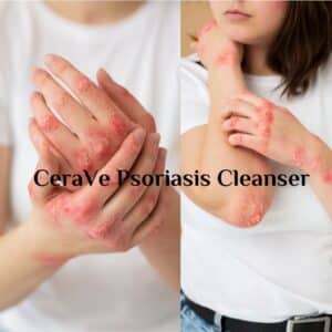 CeraVe Psoriasis Cleanser soothe and renew your skin 2024