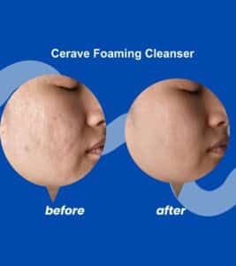 CeraVe Foaming Cleanser for normal to oily skin 2024