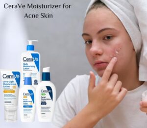 Best moisturizer for acne skin in 2025