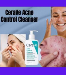 Acne control cleanser in 2025