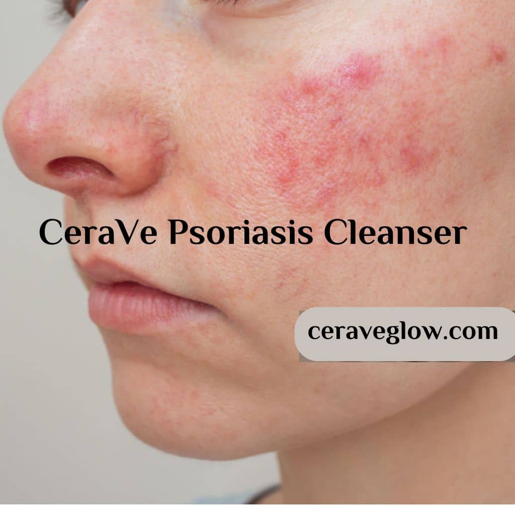 CeraVe Psoriasis Cleanser soothe and renew your skin 2024