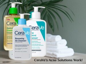 CeraVe Products for Acne-Prone Skin