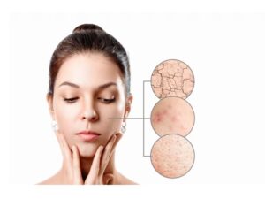Cerave Vs. Neutrogena: Which is Better for You?